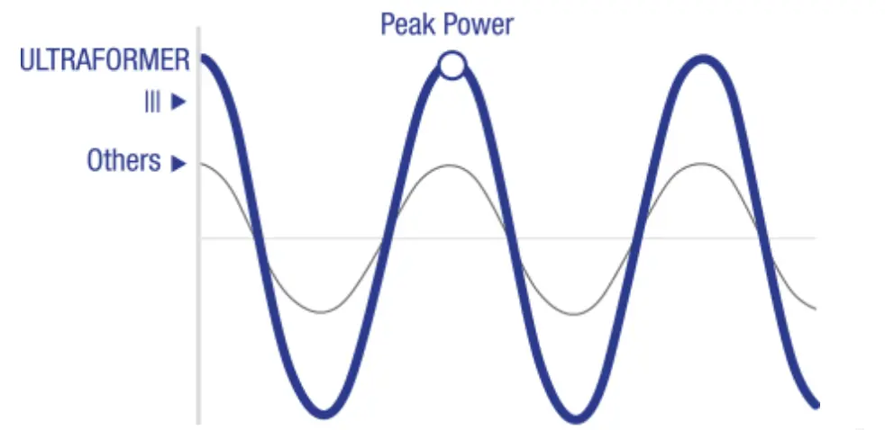 7d ultrasonic scalpel dual engine high peak power