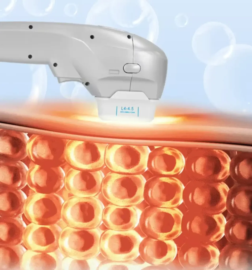 7d ultrasonic scalpel shot